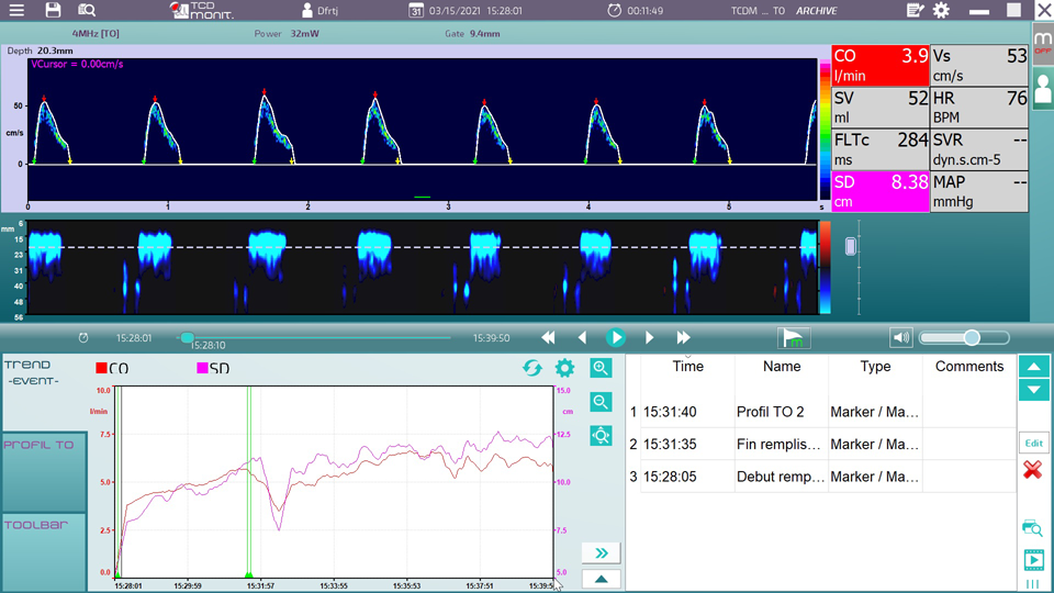 Cardiac Output Monitor